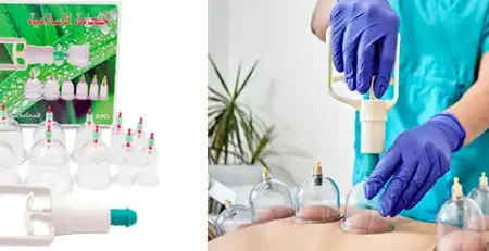 Kit hijama 12 pièces avec pompe manuelle GAPE – ventouses en plastique médical pour cupping therapy