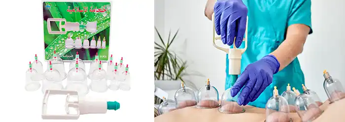Kit hijama 12 pièces avec pompe manuelle GAPE – ventouses en plastique médical pour cupping therapy
