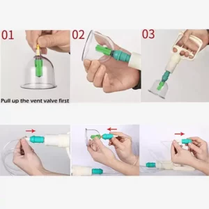 Pompe à Vide Hijama Grand Modèle en plastique blanc avec embout vert, pour usage intensif avec ventouses hijama